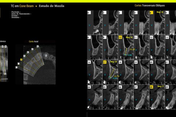 Exame para Implantodontia