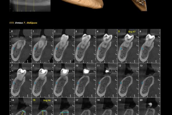 Exame tomográfico para uma região produzido na Odonto,i Diagnósticos.